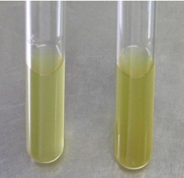 大腸埃希菌在培養(yǎng)基中的生長情況